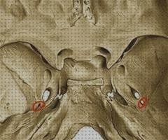 Review de cuña de carhartt audiometría