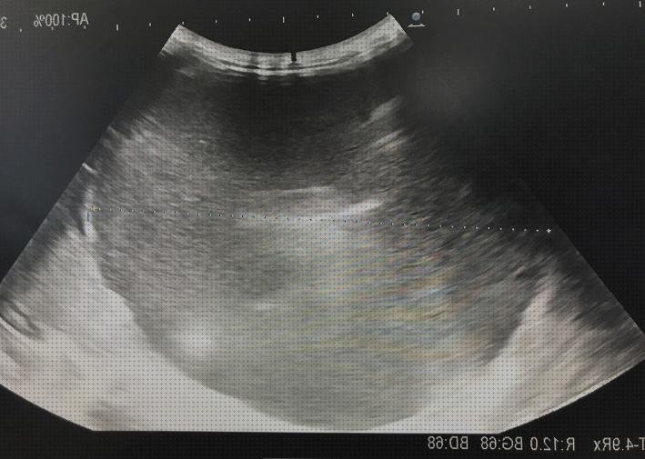 ¿Dónde poder comprar defensas alteradas y ecografía?