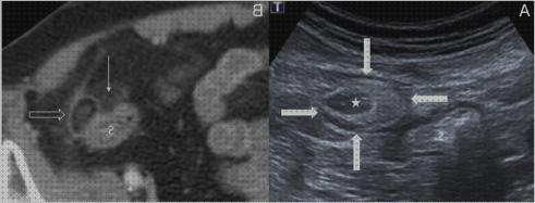 Las 5 Mejores Defensas Alteradas Y Ecografías
