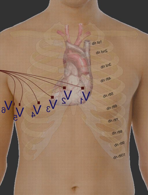 ¿Dónde poder comprar derivaciones derivaciones electrocardiograficas veterinaria?