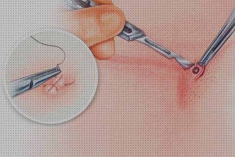 ¿Dónde poder comprar bisturi dermatologia?