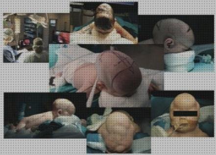 ¿Dónde poder comprar lavaojos dispositivo lavaojos intraocular?