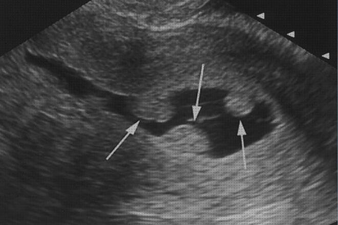 Las mejores marcas de endometrial