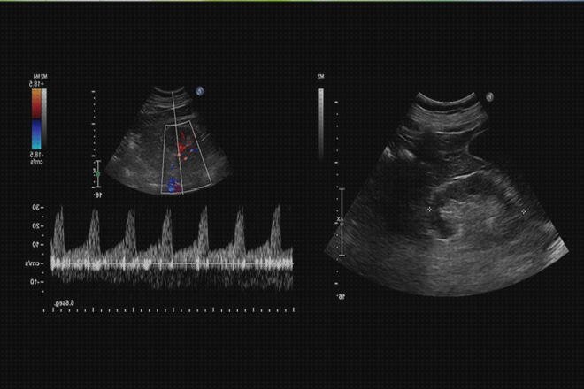 Las mejores marcas de doppler obstetrica