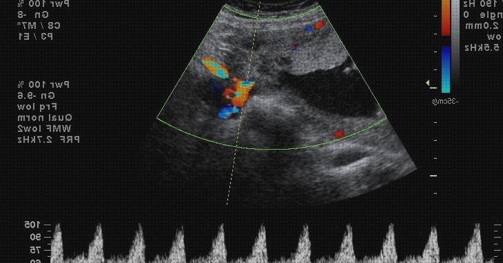 Las mejores marcas de doppler tontos