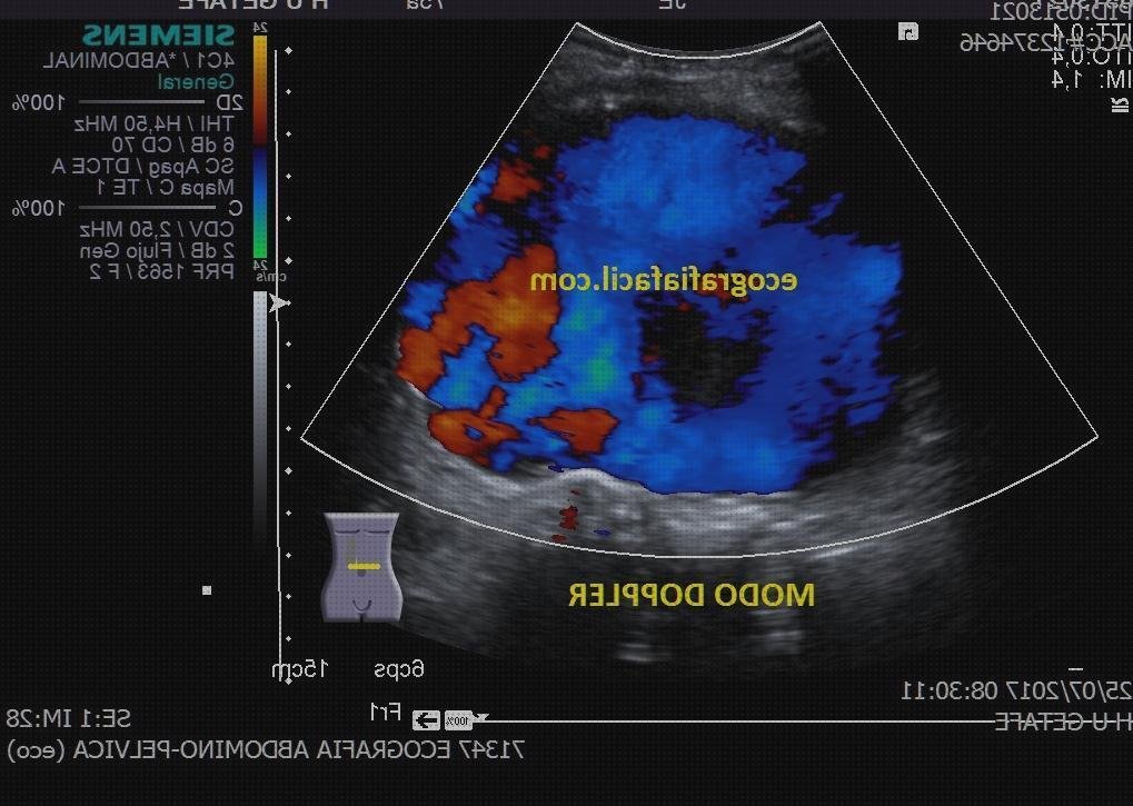 ¿Dónde poder comprar eco dopplear abdominal?