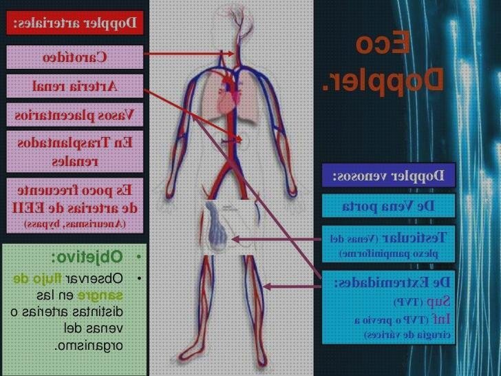Las mejores marcas de eco dopplear abdominal