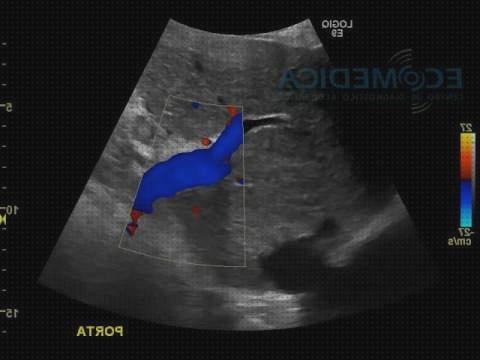 Mejores 16 ecos dopplear abdominales del mundo