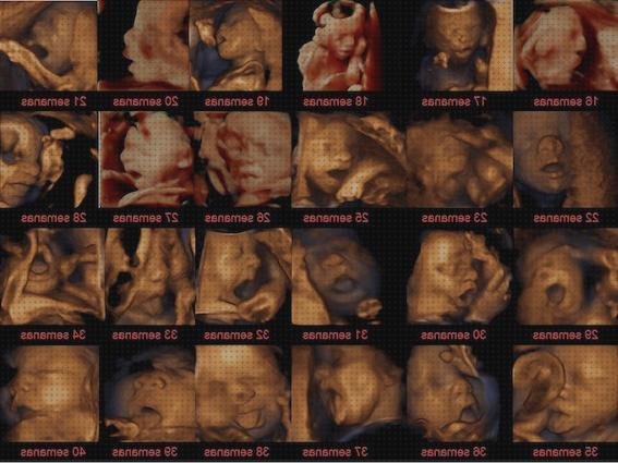 ¿Dónde poder comprar ecografía 12 semanas doppler ecografía doppler eco doppler antes de las 20 semanas?