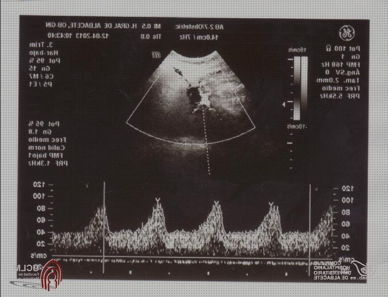 ¿Dónde poder comprar doppler eco doppler arteria uterina?