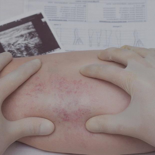 Review de eco doppler avanzado en perros