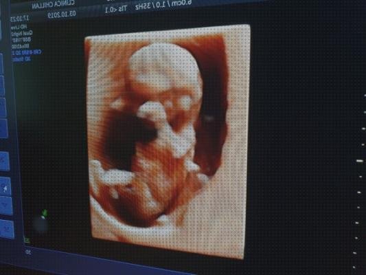 ¿Dónde poder comprar ecos doppler eco doppler bebe?