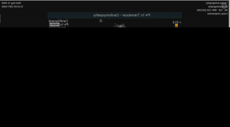 Los 16 Mejores ecos doppler cardiologia para comprar