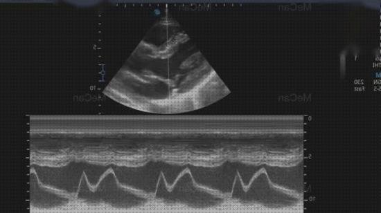 Las mejores marcas de doppler eco doppler cardiologico