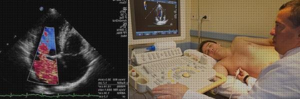 Los mejores 8 Ecos Doppler Colores Corazones