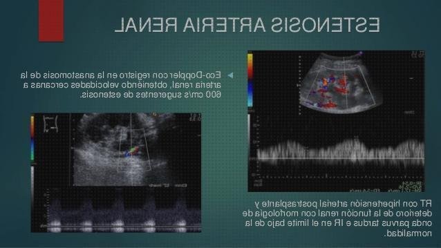 ¿Dónde poder comprar arterias doppler eco doppler color de arterias renales?