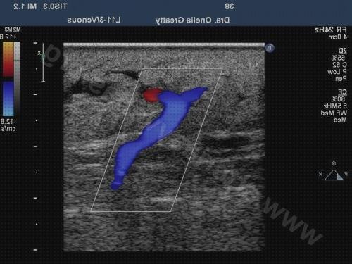 ¿Dónde poder comprar colores ecos doppler eco doppler color rojo?