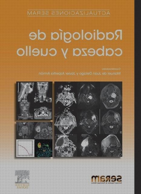¿Dónde poder comprar seram doppler eco doppler de cuello seram?