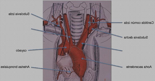 Los 8 Mejores Ecos Doppler De Troncos Carotida