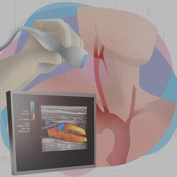 Los 22 Mejores ecos doppler diabetes