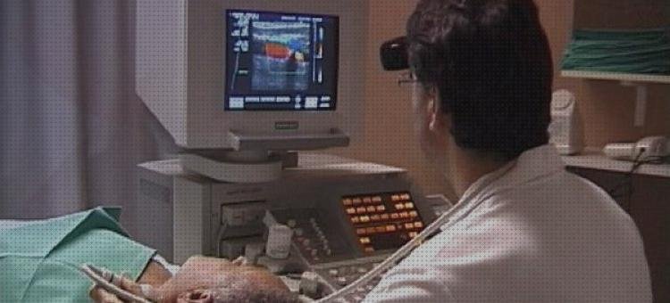 Las mejores cardiacos ecos doppler eco doppler e a cardiaco