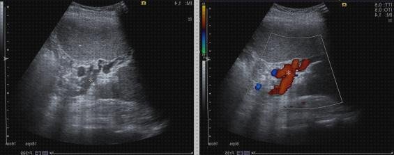 Análisis de los 7 mejores ecos doppler elsevier
