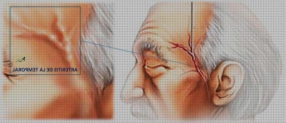 Opiniones de Mas explicación eco doppler medicina Mas eco doppler transtoracico ecografía doppler eco doppler en artritis