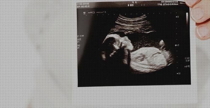 Las mejores ecos doppler eco doppler fertilidad