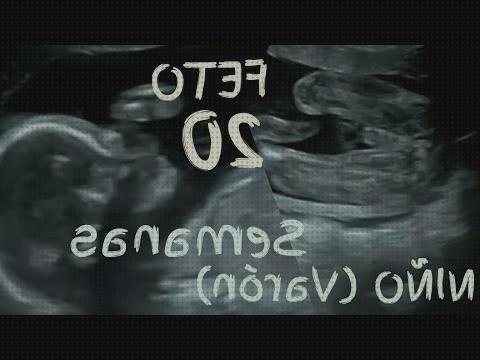 Los mejores 10 Ecos Doppler Fetal 20 Semanas