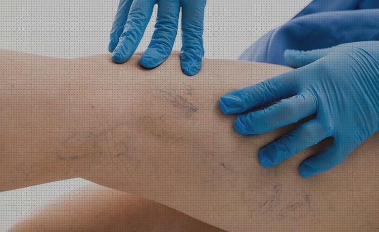 Las mejores doppler eco doppler hemorroides