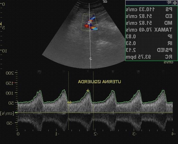 Las mejores marcas de doppler eco doppler maracay
