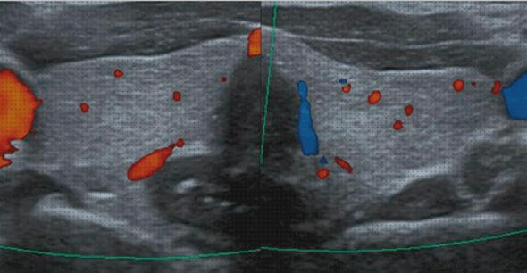 Review de eco doppler normal y alterado