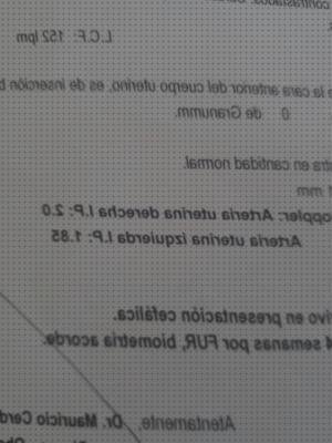 Análisis de los 3 mejores Ecos Doppler Normales Y Alterados