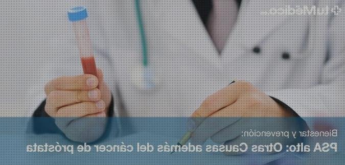 ¿Dónde poder comprar doppler eco doppler psa?