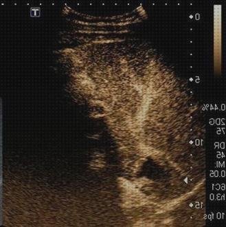 Análisis de los 5 mejores Ecos Doppler Renales Con Contrastes