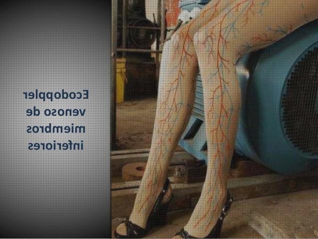 Las mejores ecos doppler eco doppler rodilla