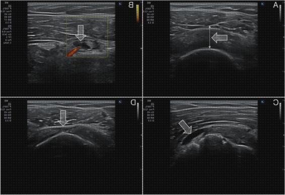 ¿Dónde poder comprar doppler eco doppler sinovitis?