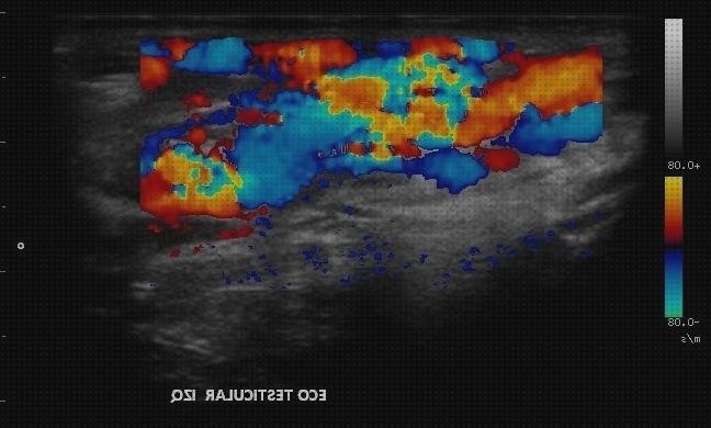 ¿Dónde poder comprar testicular doppler eco doppler testicular nivel 1?