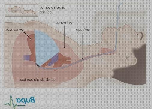 Análisis de los 21 mejores Ecos Doppler Transesofágico