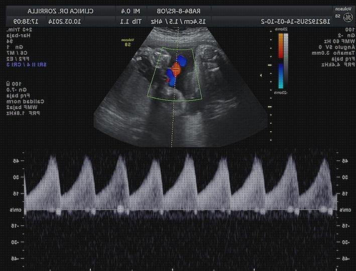 Review de los 15 mejores ecos doppler vaginas