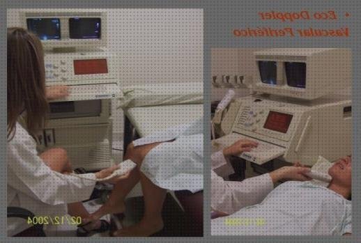 Las mejores marcas de eco doppler y ecografia ecografía doppler eco doppler vascular