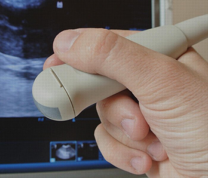 Las mejores eco doppler y ecografia ecografía doppler eco doppler vascular