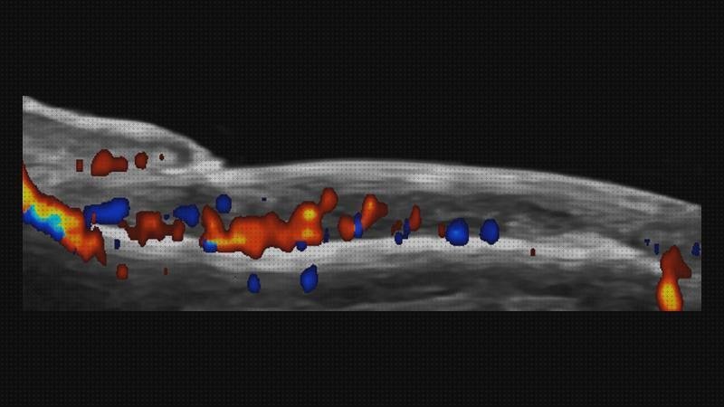 Las mejores ecos doppler eco doppler vascular precio