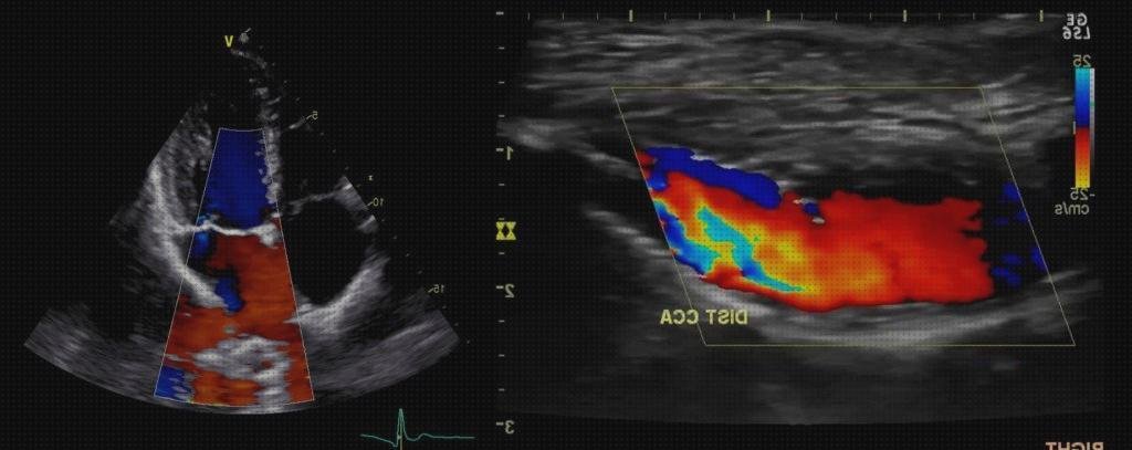 Los mejores 7 Ecos Doppler Venosos A Domicilios