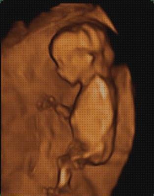 ¿Dónde poder comprar ecografía 11 semanas gestacion ecografía once semanas ecografía 11 semanas 4d?