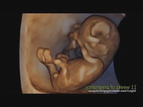 Las mejores ecografía 11 semanas gestacion ecografía once semanas ecografía 11 semanas 4d