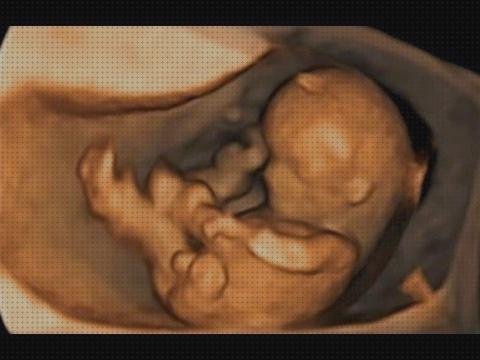 Opiniones de ecografía 11 semanas gestacion ecografía once semanas ecografía 11 semanas 4d