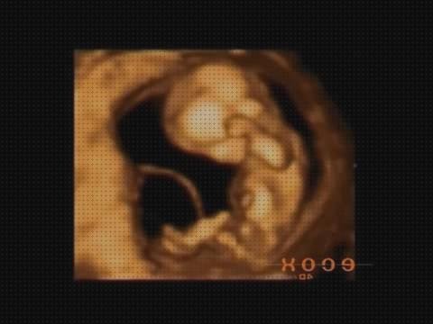 Las mejores marcas de Mas ecografía 12 semanas niño niña ecografía once semanas ecografía 12 semanas de embarazo 3d