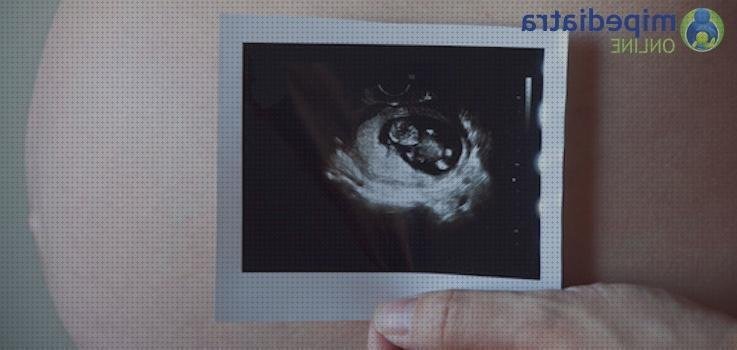 Las mejores ecografía once semanas ecografía 12 semanas estadistica