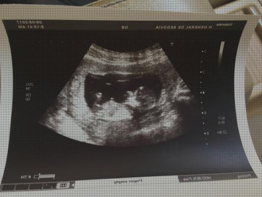 Las mejores marcas de ecografía once semanas ecografía 12 semanas niño